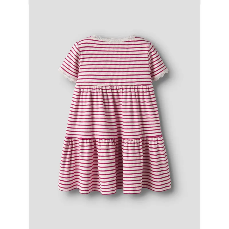 Name It Love Potion Nmffensina Ss Dress Pb 5